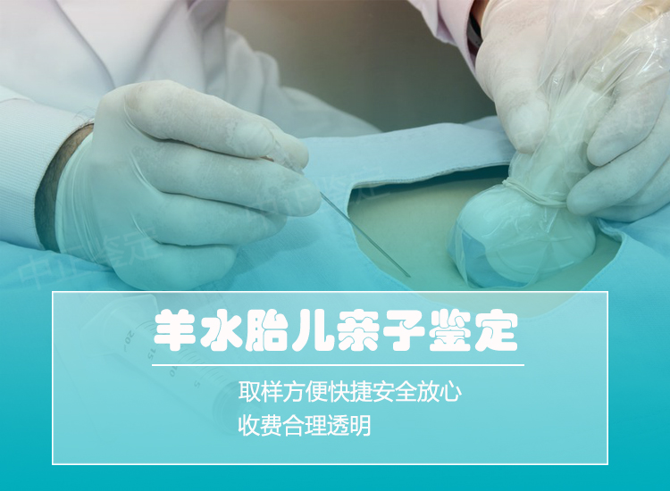 建德市羊水孕期亲子鉴定